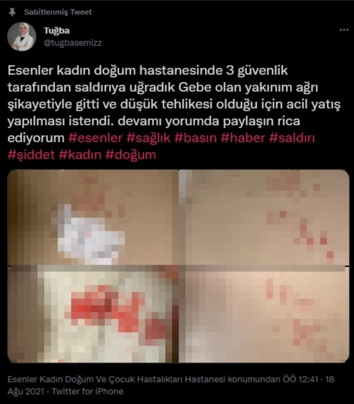 Kadın doğum hastanesinde güvenlik şiddeti: Hasta yakınlarına saldırdılar