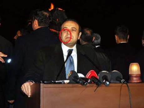 Bağış'a yumurtalı protesto (08.12.2011)