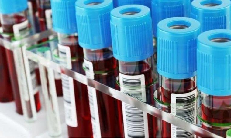 Singapur'da çoğunluğu yabancı binlerce kişinin HIV ve sağlık kayıtları sızdırıldı