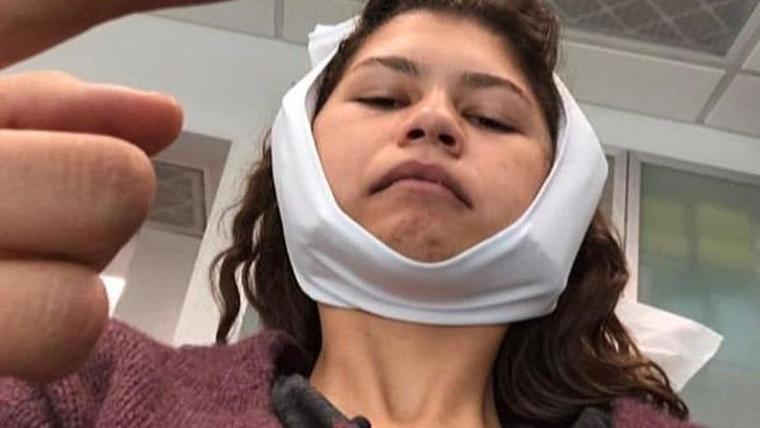 Zendaya'nın ameliyat sonrası paylaşımları şaşırttı