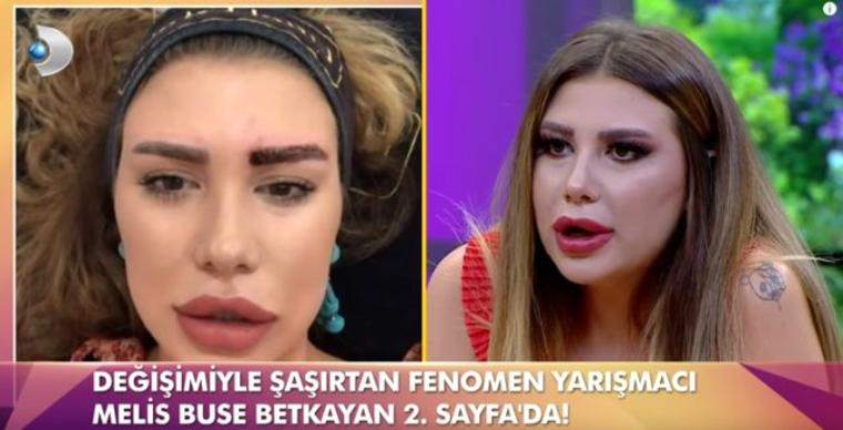 Kısmetse Olur yarışmacısı tanınmaz halde! (30.04.2019)