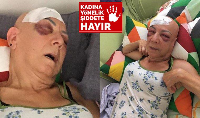 Kayınvalidesini vuran damada 8 yıl hapis