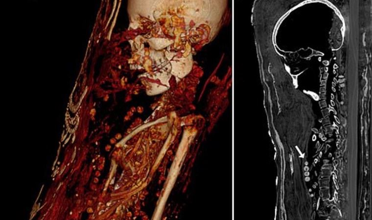 Bilgisayarlı tomografi Mısır’daki mumyaların sırlarını ortaya çıkardı