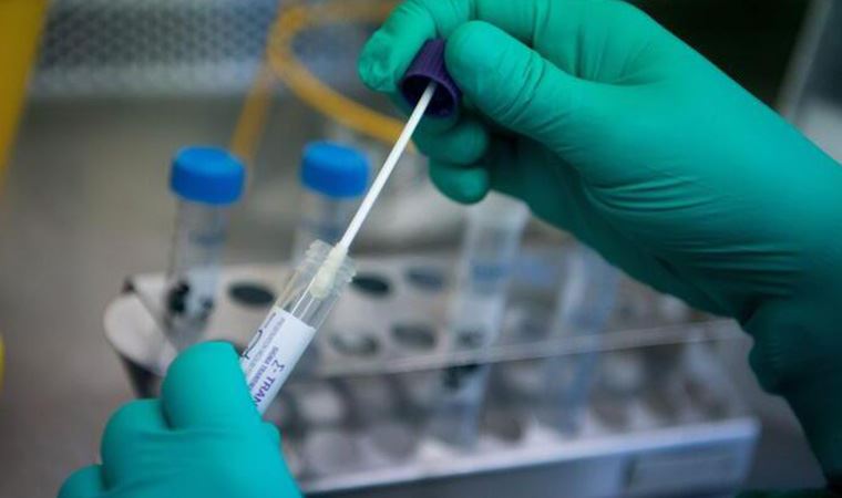 PCR testi isteyen ülkelere gidecekler ücretli test yaptırabilecek