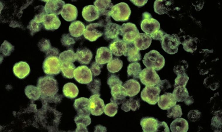 Naegleria fowleri: ABD'de 'beyin yiyen amip' vakası görüldü