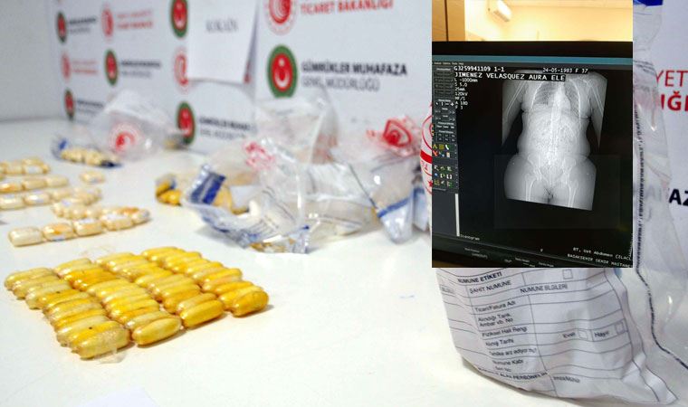 İstanbul Havalimanı'nda 3 kişinin midelerindeki uyuşturucu kapsülleri böyle görüntülendi