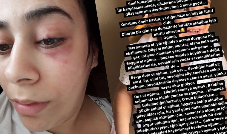 Hatice İnci: Çocuğumu ve beni koruyun, Emine Bulut gibi ölmek istemiyorum