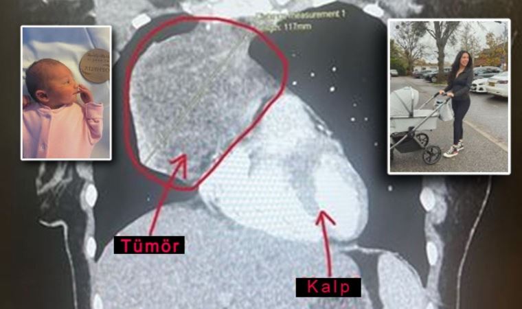 Doğmamış bebeği hayatını kurtardı: 'Ultrasonda öğrendi...'