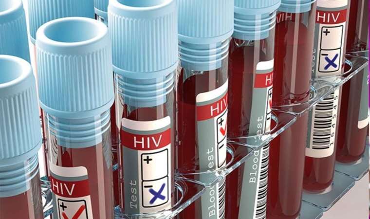 Yeni HIV aşısının denemelerine başlandı