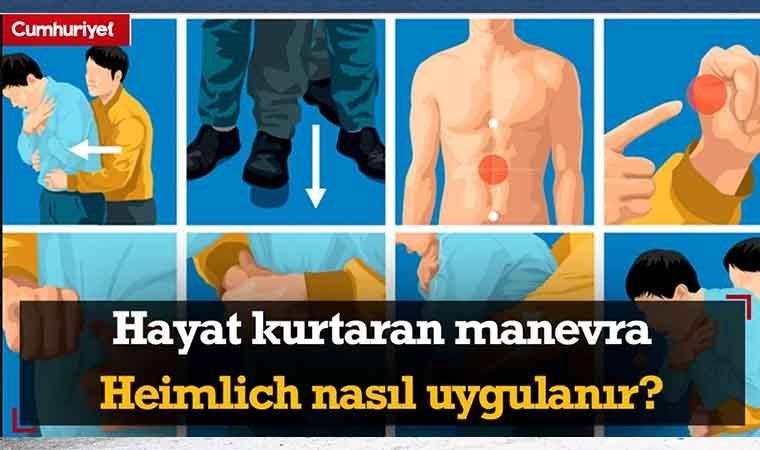 Hayat kurtaran manevra Heimlich nedir? Nasıl uygulanır?