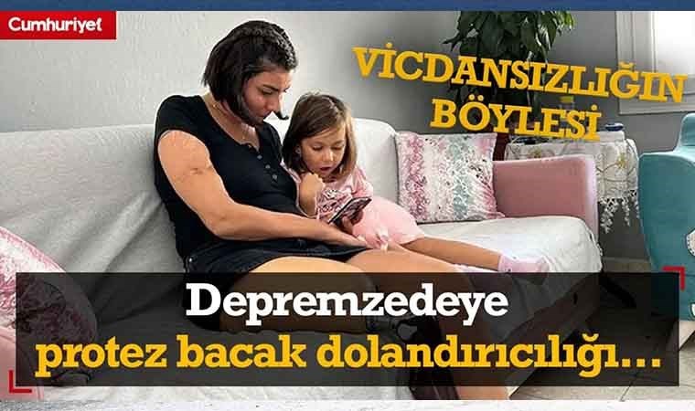 Akılalmaz protez bacak dolandırıcılığı!