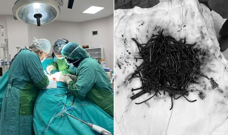 Doktorlar bile şaşırdı: Midesinden 1 kilo metal cisim çıktı!