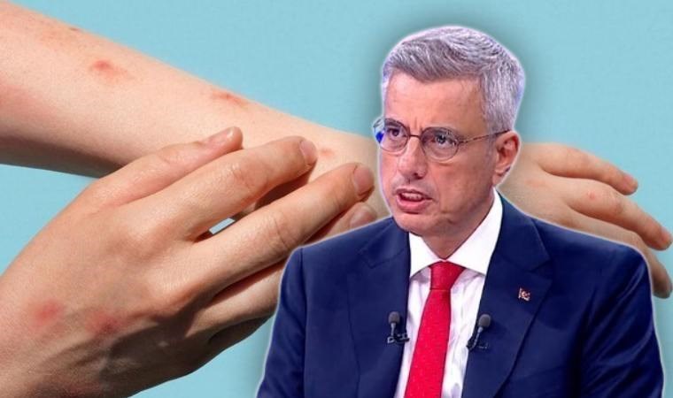 Bakan Memişoğlu'ndan yeni 'maymun çiçeği' açıklaması: Hastanelere başvuran insanlarımız oluyor