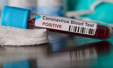 Covid-19 testlerinin pozitiflik oranında korkutan artış