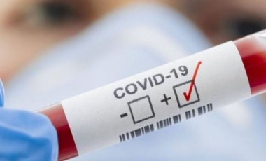 Covid-19 testlerini yanıltmak için kullanılan numara ortaya çıkarıldı