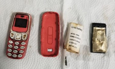 Kosova'da hastanın midesinden ameliyatla Nokia 3310 çıkarıldı