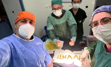 Safra kesesinden 1250 taş çıktı, doktor ismini yazdı (17 Mayıs 2022) (Video Haber)