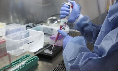 Panama’da gizemli hepatit vakası görüldü