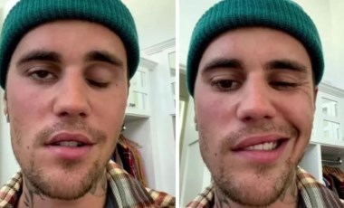 Şarkıcı Justin Bieber kısmi yüz felci geçirdi