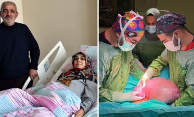 Karnını kaplayan kitle operasyonla çıkartıldı, doktorlar bile şaşırdı: 'Çok nadir görüyoruz'