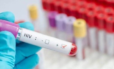 HIV erken tanı ve tedaviyle 