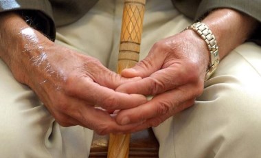 Parkinson tedavisi için kök hücre deneyi