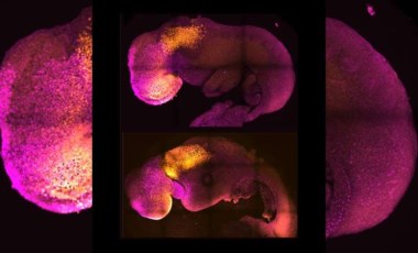 Bilim insanları, kök hücre kullanarak sentetik insan embriyoları oluşturdu
