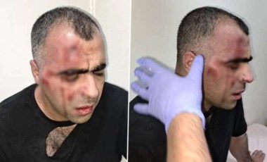 Gazeteci Sinan Aygül'e saldırıda yeni gelişme: Koruma polisi açığa alındı