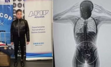 Vajinasına sakladığı yüklü miktarda uyuşturucu X-ray cihazına takıldı