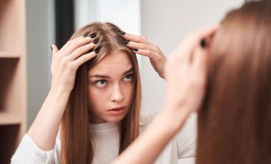 Understanding Scalp Acne: Causes and Precautions