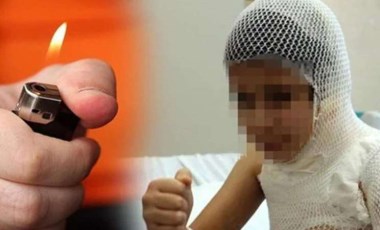 Videodan etkilenerek kolonyayla kendini yakmıştı: 9 yaşındaki çocuk ameliyat edildi