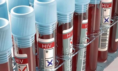 Yeni HIV aşısının denemelerine başlandı