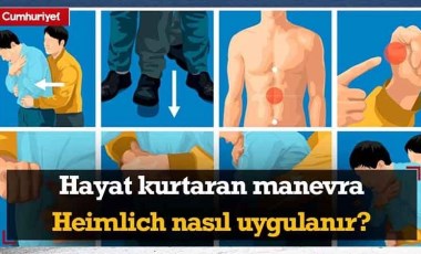 Hayat kurtaran manevra Heimlich nedir? Nasıl uygulanır?