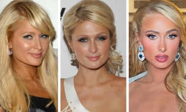 Paris Hilton: 'Tamamen doğalım, hiç estetik yaptırmadım'