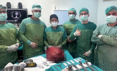 Doktorlar bile şaşırdı: 13 kiloluk kitle çıkarıldı!