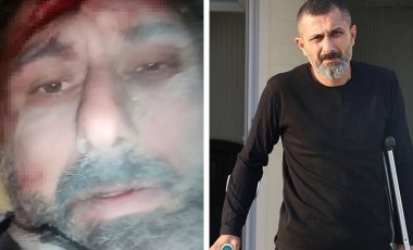 Enkaz altında çektiği video ile tanınmıştı... Dehşet veren anları anlattı: 'Mezardan dar bir yerde 4 gün kaldım'