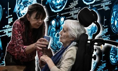 Laboratuvarda üretildi: Alzheimer'a karşı yeni keşif