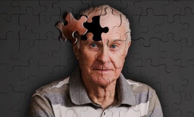 Araştırma: Alzheimer belirtileri erken teşhis edilebilir