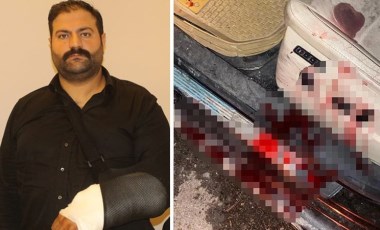 Antalya'da Avukat Gökhan Kadir Gülaçar'a silahlı saldırı: 'Mr. Oliver'in dosyalarından çekil demedik mi?'