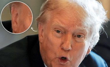 Trump'ın bandajsız ilk fotoğrafı tartışma yarattı