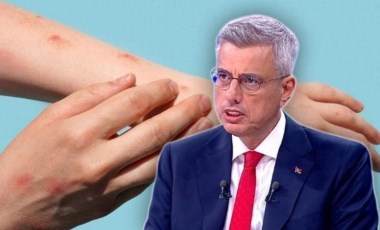 Bakan Memişoğlu'ndan yeni 'maymun çiçeği' açıklaması: Hastanelere başvuran insanlarımız oluyor