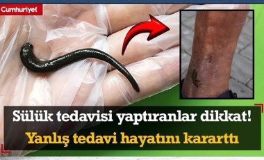 Sülük tedavisi yaptıranlar dikkat! Yanlış tedavi hayatını kararttı