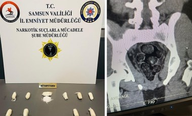 Midesinde uyuşturucu taşıyan kişi, havalimanında yakalandı