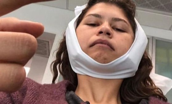 Zendaya'nın ameliyat sonrası paylaşımları şaşırttı