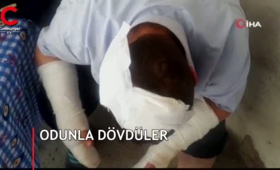 İki kayın biraderi tarafından odunla dövüldü