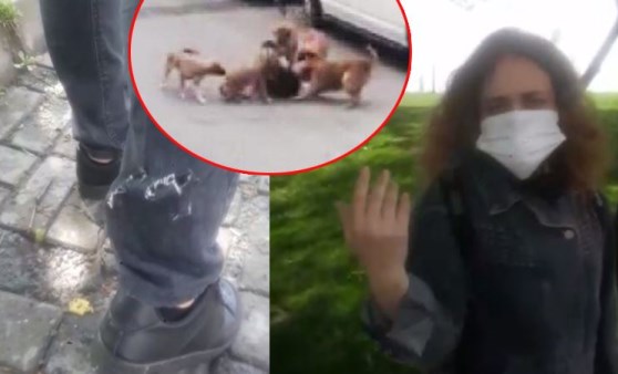 Sultangazi'de işe giden kadın başıboş köpeklerin saldırısına uğradı