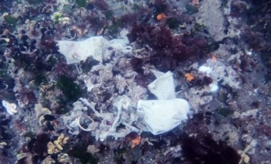 Utandıran görüntüler! Korkunç manzarayı gözler önüne serdi