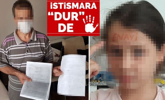 Cinsel istismara uğradığı iddia edilen kızının alnına 'enayi' yazıp fotoğrafını gönderdi