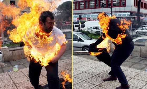 O 'dehşet fotoğraf'taki kişi konuştu:  Ateşe yaklaşamıyorum