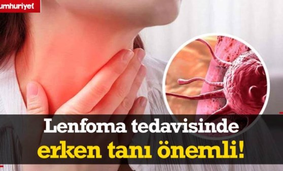 Lenf kanseri nedir? Erken yakalanan lenfomada tedavi başarısı yüksek